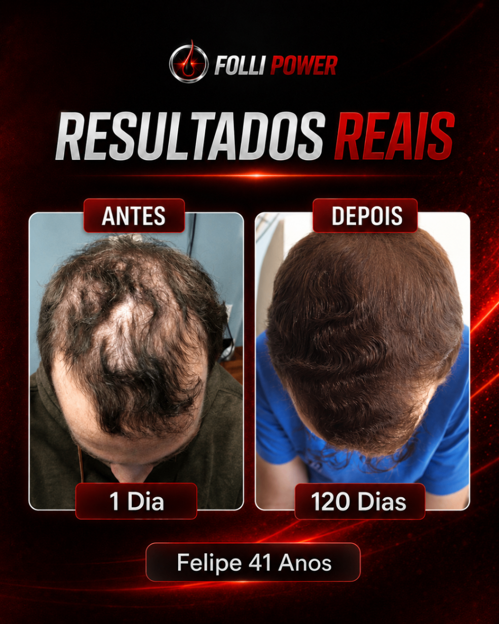 Antes e depois do cliente Felipe, 41 anos