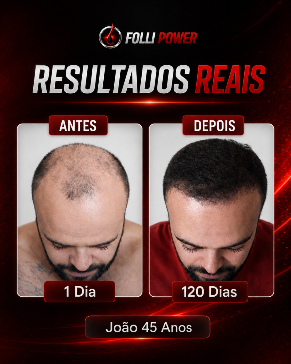 Antes e depois do cliente João, 45 anos