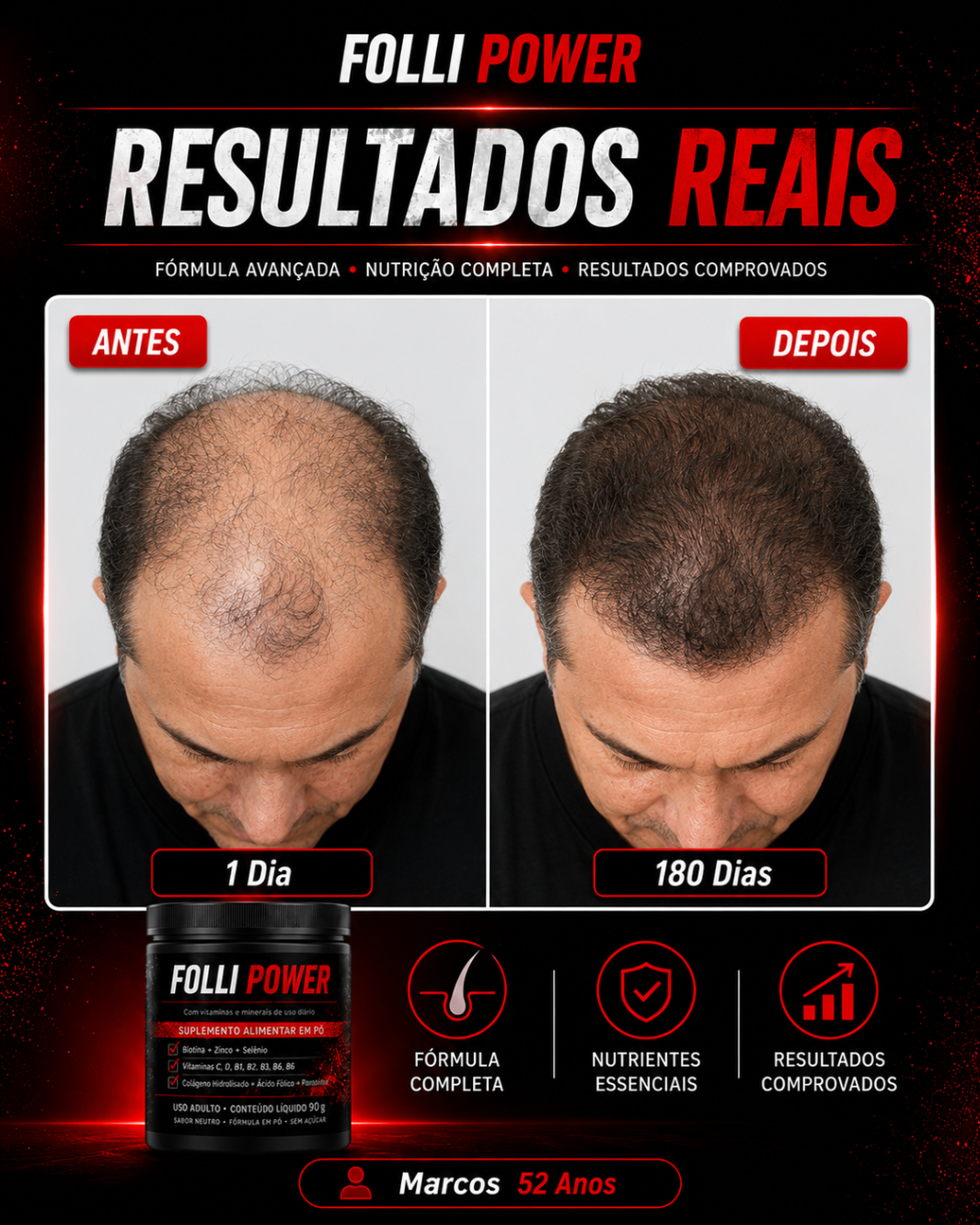 Antes e depois do cliente Marcos, 52 anos