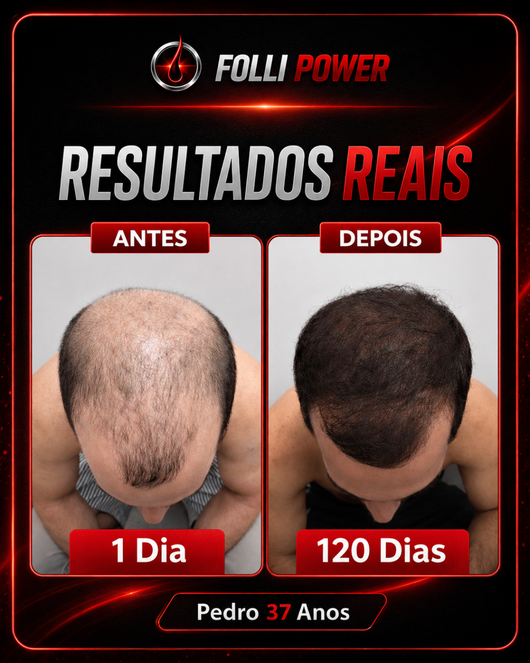 Antes e depois do cliente Pedro, 37 anos