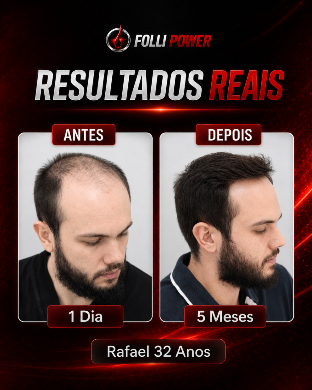 Antes e depois do cliente Rafael, 32 anos