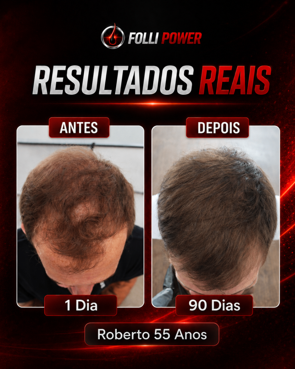 Antes e depois do cliente Roberto, 55 anos
